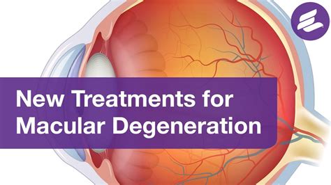 Summary Researchers have made an exciting finding in the "dry" form of age-related macular. . Dry macular degeneration treatment breakthroughs 2022